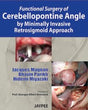 FUNCTIONAL SURGERY OF CEREBELLOPONTINE ANGLE BY MINIMALLY INVASIVE RETROSIGMOID APPROACH - Retail Maharaj