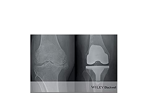 ABC of Orthopaedics and Trauma: 257 (ABC Series) - Retail Maharaj