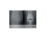 ABC of Orthopaedics and Trauma: 257 (ABC Series) - Retail Maharaj