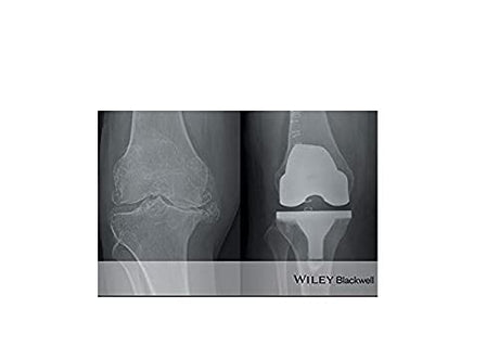 ABC of Orthopaedics and Trauma: 257 (ABC Series) - Retail Maharaj