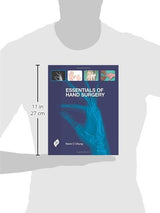 Essentials of Hand Surgery - Retail Maharaj