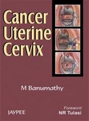 Cancer Uterine Cervix - Retail Maharaj