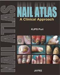 NAIL ATLAS A CLINICAL APPROACH - Retail Maharaj