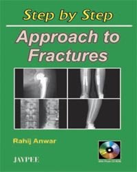 STEP BY STEP APPROACH TO FRACTURES WITH CD-ROM - Retail Maharaj