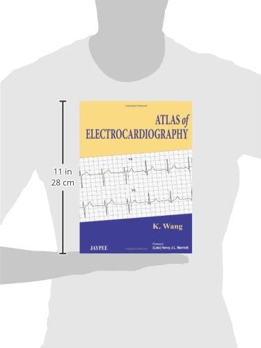 Atlas of Electrocardiography - Retail Maharaj