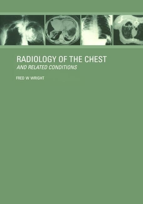 RADIOLOGY OF THE CHEST AND RELATED CONDITIONS WITH CD-ROM: Together with an extensive illustrative collection of radiographs, conventional and ... for Mac and Windows version 3.1 or later) - Retail Maharaj