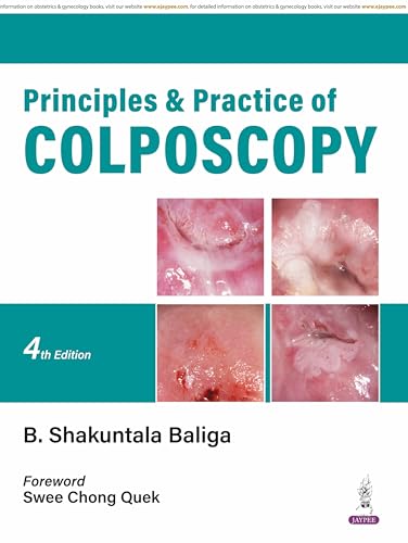 Principles & Practice of Colposcopy - Retail Maharaj