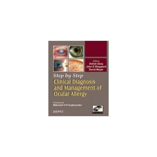 Step By Step Clinical Diagnosis And Management To Ocular Allergy With Photo Cd-rom - Retail Maharaj