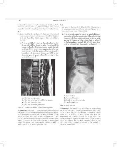 MCQs in Pain Medicine, 2/e | Over 2100 MCQs (PB 2026) - Retail Maharaj