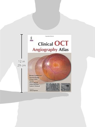 Clinical Oct Angiography Atlas - Retail Maharaj
