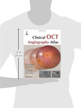 Clinical Oct Angiography Atlas - Retail Maharaj
