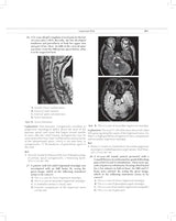MCQs in Pain Medicine, 2/e | Over 2100 MCQs (PB 2026) - Retail Maharaj