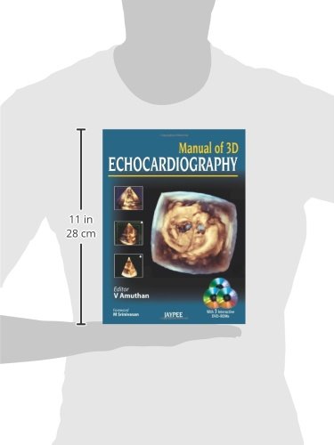 Manual of 3D Echocardiography - Retail Maharaj
