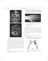 MCQs in Pain Medicine, 2/e | Over 2100 MCQs (PB 2026) - Retail Maharaj
