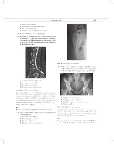 MCQs in Pain Medicine, 2/e | Over 2100 MCQs (PB 2026) - Retail Maharaj