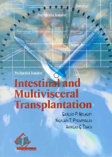 INTESTINAL AND MULTIVISCERAL TRANSPLANTATION - Retail Maharaj