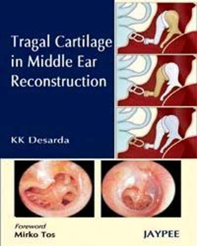 TRAGAL CARTILAGE IN MIDDLE EAR RECONSTRUCTION - Retail Maharaj