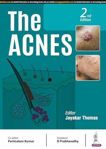 The Acnes - Retail Maharaj