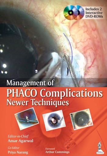 MANAGEMENT OF PHACO COMPLICATIONS NEWER TECHNIQUES INCLUDES 2 INT.DVD-ROM - Retail Maharaj