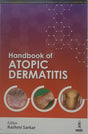 Handbook of Atopic Dermatitis - Retail Maharaj