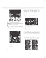 MCQs in Pain Medicine, 2/e | Over 2100 MCQs (PB 2026) - Retail Maharaj