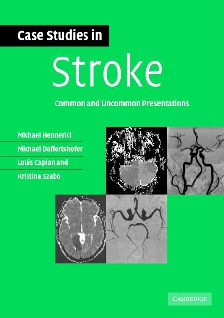 Case Studies in Stroke: Common and Uncommon Presentations - Retail Maharaj