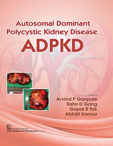 Autosomal Dominant Polytechnic Kidney Disease ADPKD - Retail Maharaj