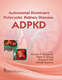 Autosomal Dominant Polytechnic Kidney Disease ADPKD - Retail Maharaj