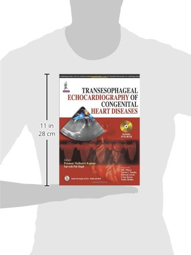 TRANSESOPHAGEAL ECHOCARDIOGRAPHY OF CONGENITAL HEART DISEASES - Retail Maharaj