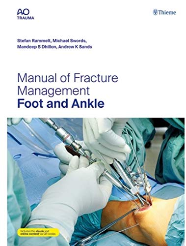 Manual of Fracture Management - Foot and Ankle - Retail Maharaj