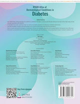 RSSDI Atlas of Dermatological Conditions in Diabetes - Retail Maharaj