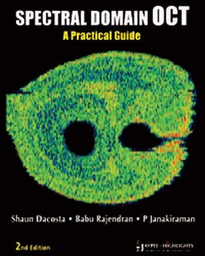 SPECTRAL DOMAIN OCT A PRACTICAL GUIDE - Retail Maharaj