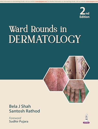 Ward Rounds in Dermatology - Retail Maharaj