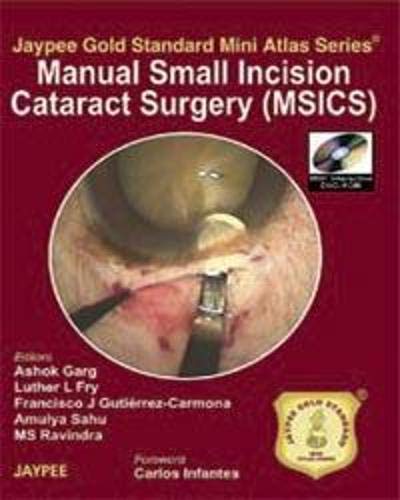 MANUAL SMALL INCISION CATARACT SURGERY (MSICS) WITH DVD-ROM JAYPEE GOLD STANDARD MINIATLAS - Retail Maharaj