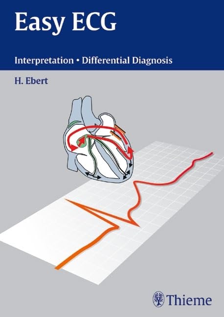 EASY ECG INTERPRETATION DIFFERENTIAL DIAGNOSIS - Retail Maharaj