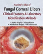ARAVIND'S ATLAS OF FUNGAL CORNEAL ULCERS CLINICAL FEATURES & LAB.IDENTIFICATION METHODS - Retail Maharaj