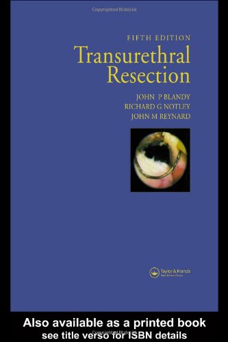 (EX)TRANSURETHRAL RESECTION - Retail Maharaj