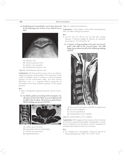 MCQs in Pain Medicine, 2/e | Over 2100 MCQs (PB 2026) - Retail Maharaj