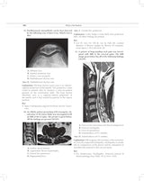 MCQs in Pain Medicine, 2/e | Over 2100 MCQs (PB 2026) - Retail Maharaj