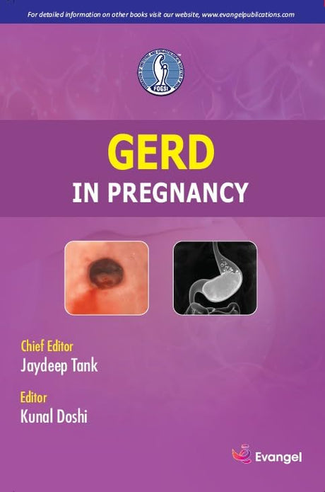 GERD IN PREGNANCY - Retail Maharaj