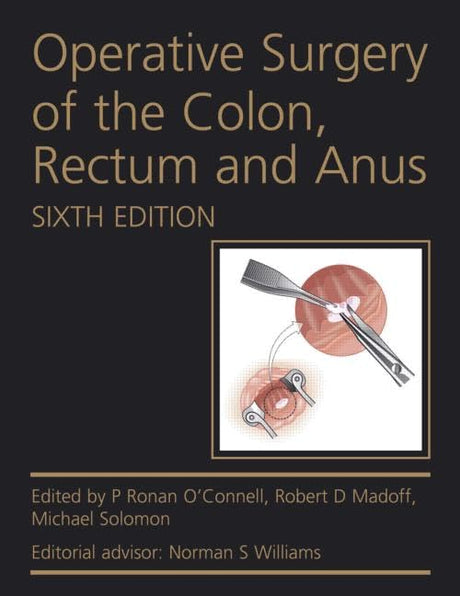 OPERATIVE SURGERY OF THE COLON,RECTUM AND ANUS - Retail Maharaj