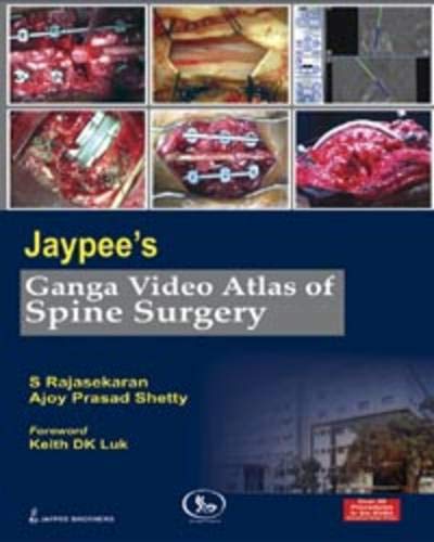 Jaypee’s Ganga Video Atlas of Spine Surgery Over 50 Procedures in 6 DVDs - Retail Maharaj