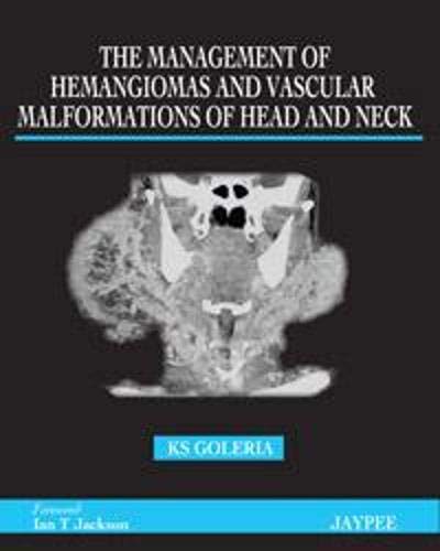 The Management of Hemangiomas and Vascular Malformations of Head and Neck - Retail Maharaj