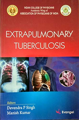 Extrapulmonary Tuberculosis, 1/e 2019 - Retail Maharaj