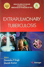 Extrapulmonary Tuberculosis, 1/e 2019 - Retail Maharaj