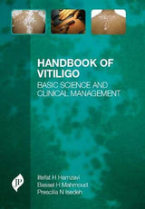 Handbook of Vitiligo - Retail Maharaj