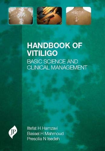 Handbook of Vitiligo - Retail Maharaj