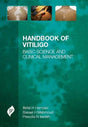 Handbook of Vitiligo - Retail Maharaj