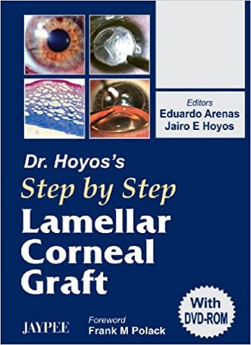 DR.HOYOS' STEP BY STEP LAMELLAR CORNEAL GRAFT WITH DVD-ROM - Retail Maharaj