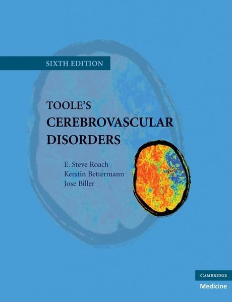 Toole's Cerebrovascular Disorders - Retail Maharaj